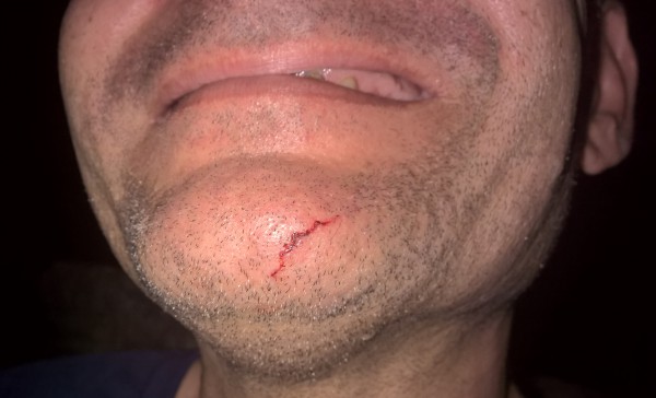 WP_20160624_22_42_36_Pro (2).jpg